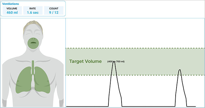 Volume of air given during ventilations and the duration of ventilations on an Adult CPR Manikin - infographic.